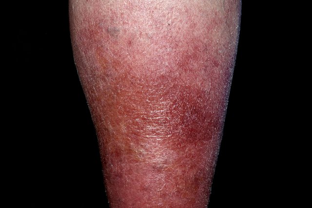 Detail Leg Images Nomer 51