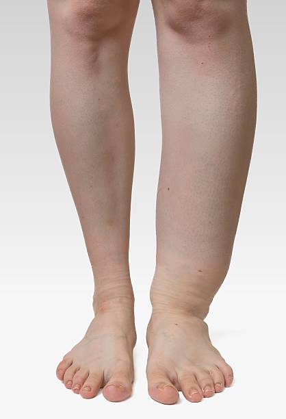 Detail Leg Images Nomer 56