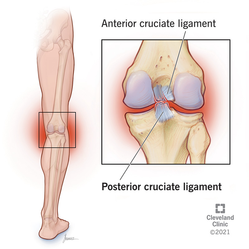 Detail Ligamentum Cruciatum Posterior Nomer 3