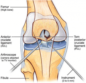 Detail Ligamentum Cruciatum Posterior Nomer 38