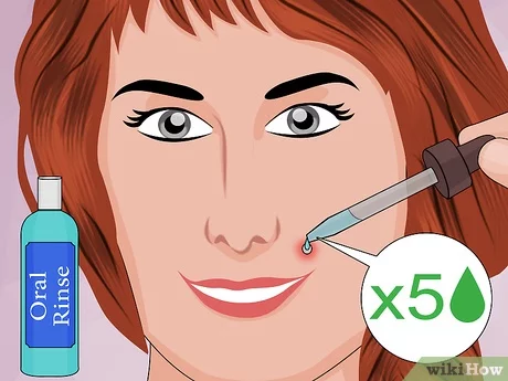 Detail Monroe Piercing Kit Nomer 29