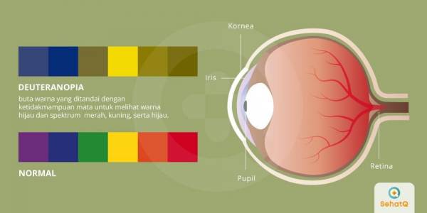 Detail Morfologi Merubah Warna Gambar Menjadi Biru Nomer 11