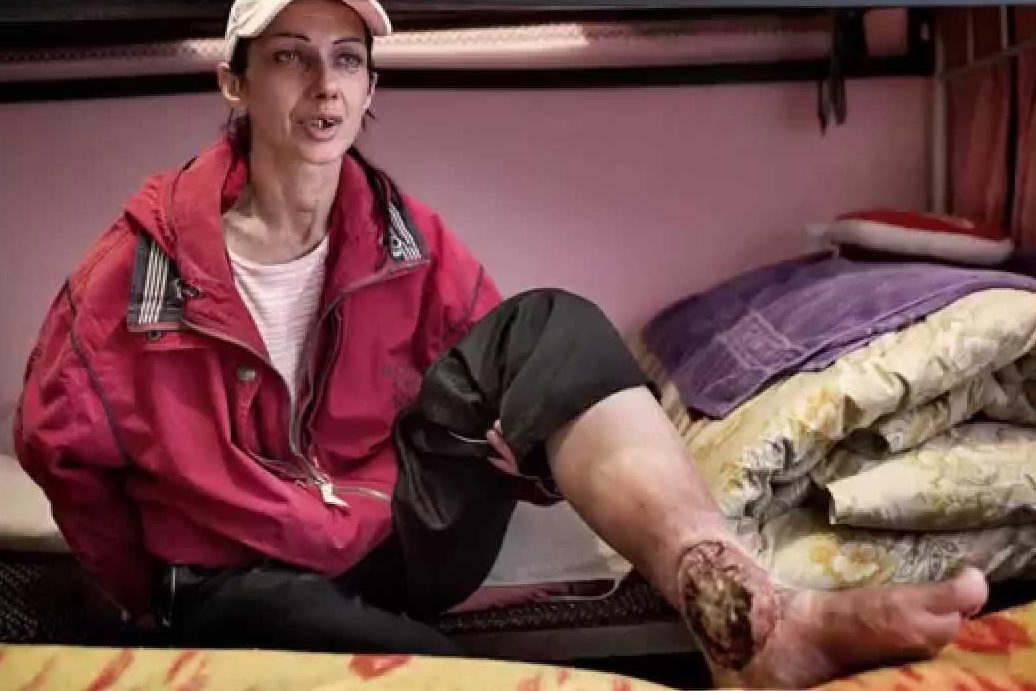 Detail New Russian Drug Krokodil Wiki Nomer 32