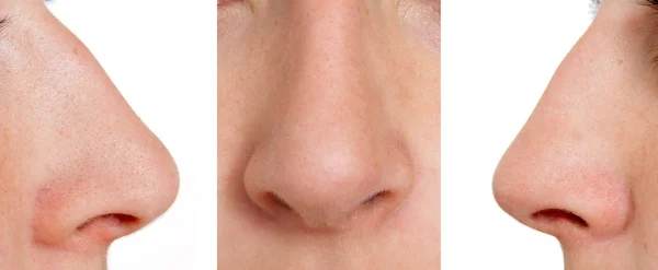 Detail Nose Image Nomer 22