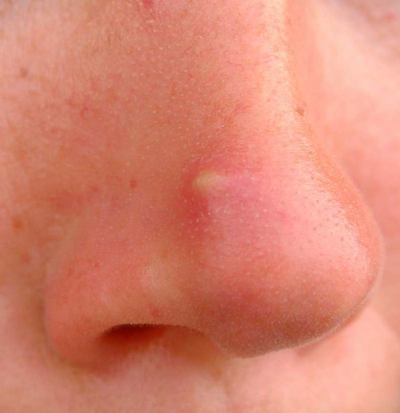 Detail Nose Image Nomer 23
