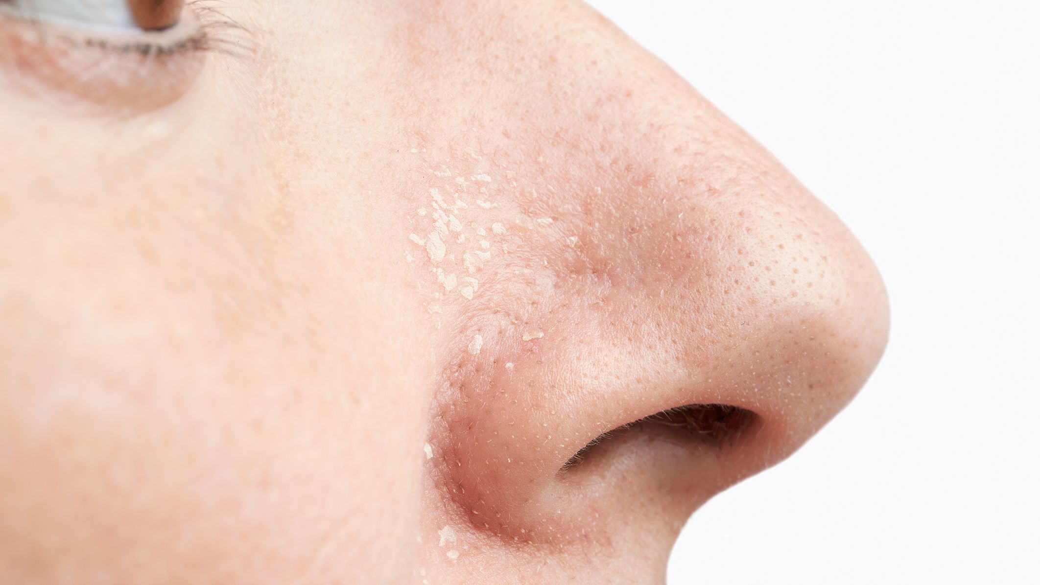 Detail Nose Image Nomer 31