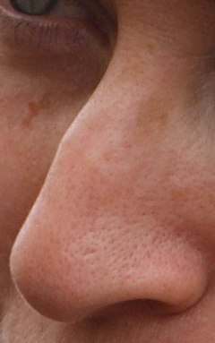 Detail Nose Image Nomer 7