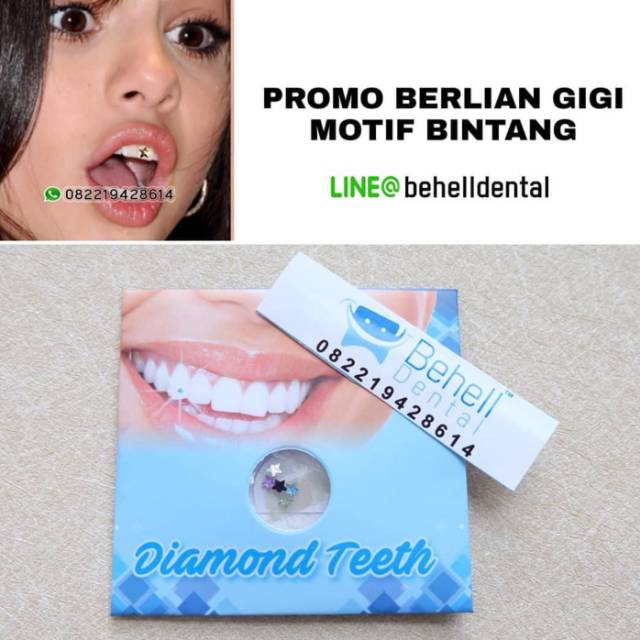 Detail Pasang Berlian Di Gigi Nomer 44