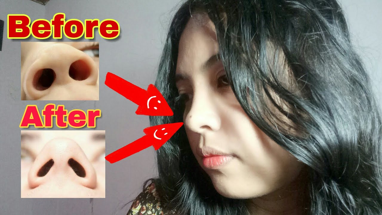 Detail Lubang Hidung Besar Nomer 21