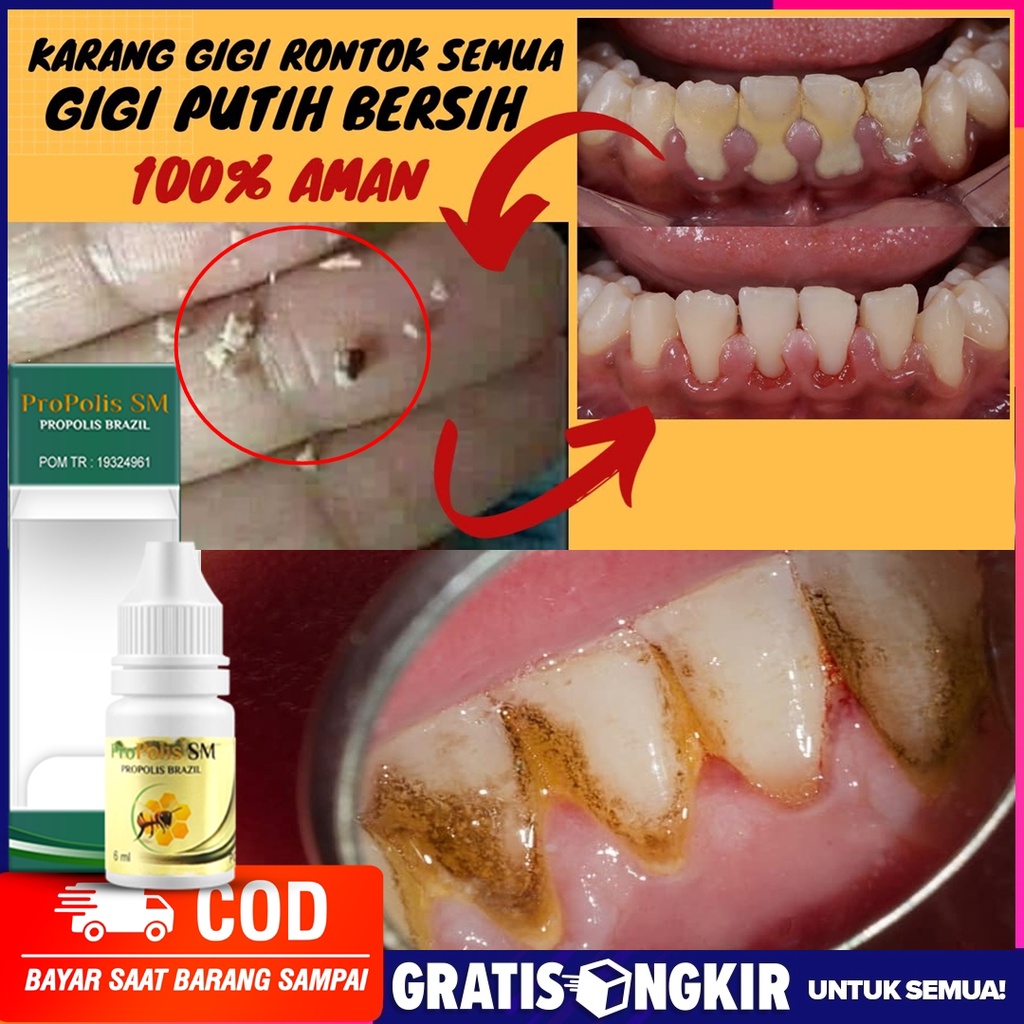 Detail Pembersih Gigi Kuning Nomer 46