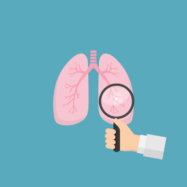 Lung Cancer Clipart - KibrisPDR