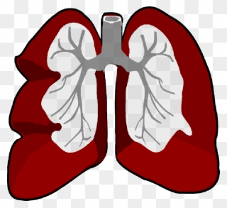 Detail Lung Cancer Clipart Nomer 13