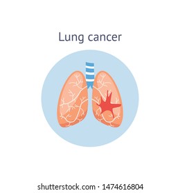 Detail Lung Cancer Clipart Nomer 20