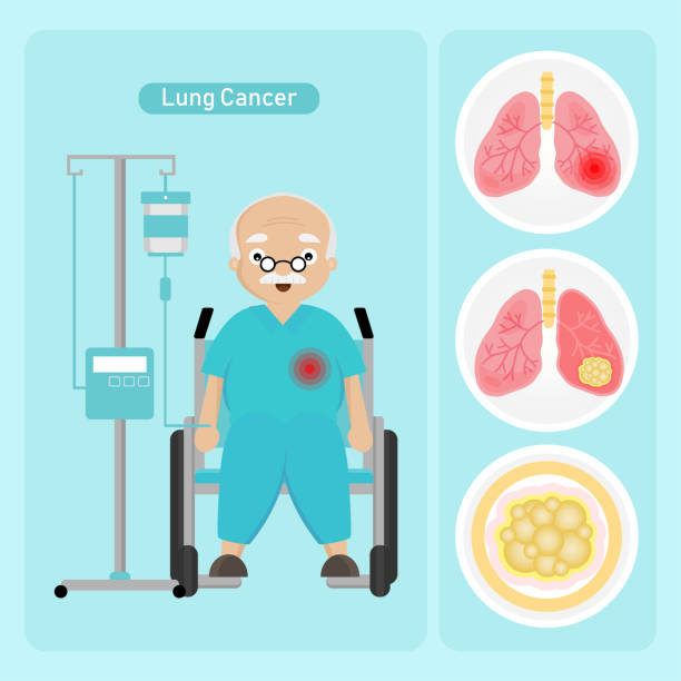 Detail Lung Cancer Clipart Nomer 27