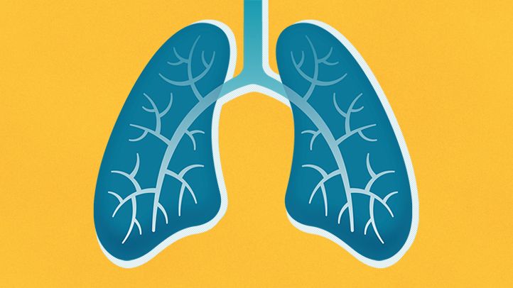 Detail Lung Cancer Clipart Nomer 44