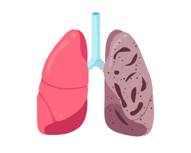 Detail Lung Clipart Nomer 30