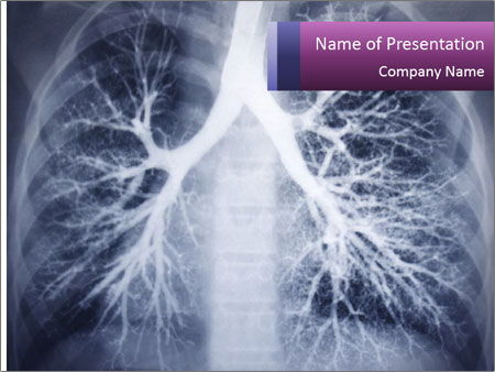 Detail Lung Powerpoint Template Nomer 22