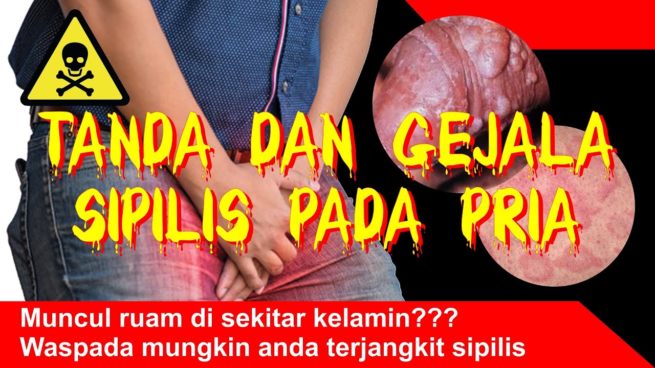 Detail Penyakit Sipilis Gambar Nomer 41