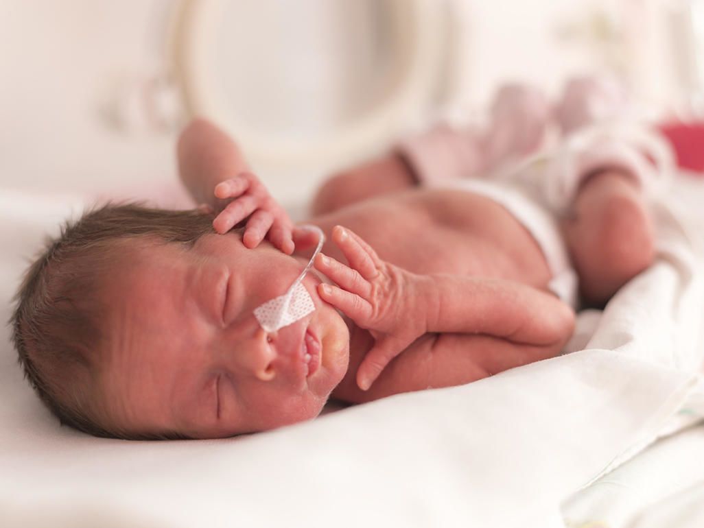 Detail Perawatan Bayi Prematur Di Rumah Nomer 2