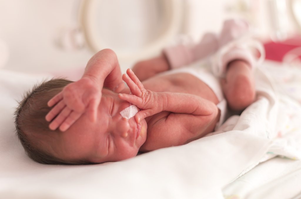 Detail Perawatan Bayi Prematur Di Rumah Nomer 8
