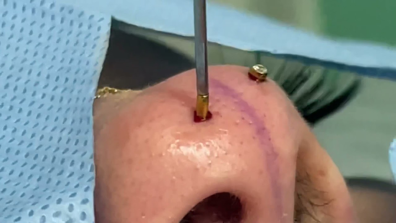 Detail Mantis Piercing Nomer 34