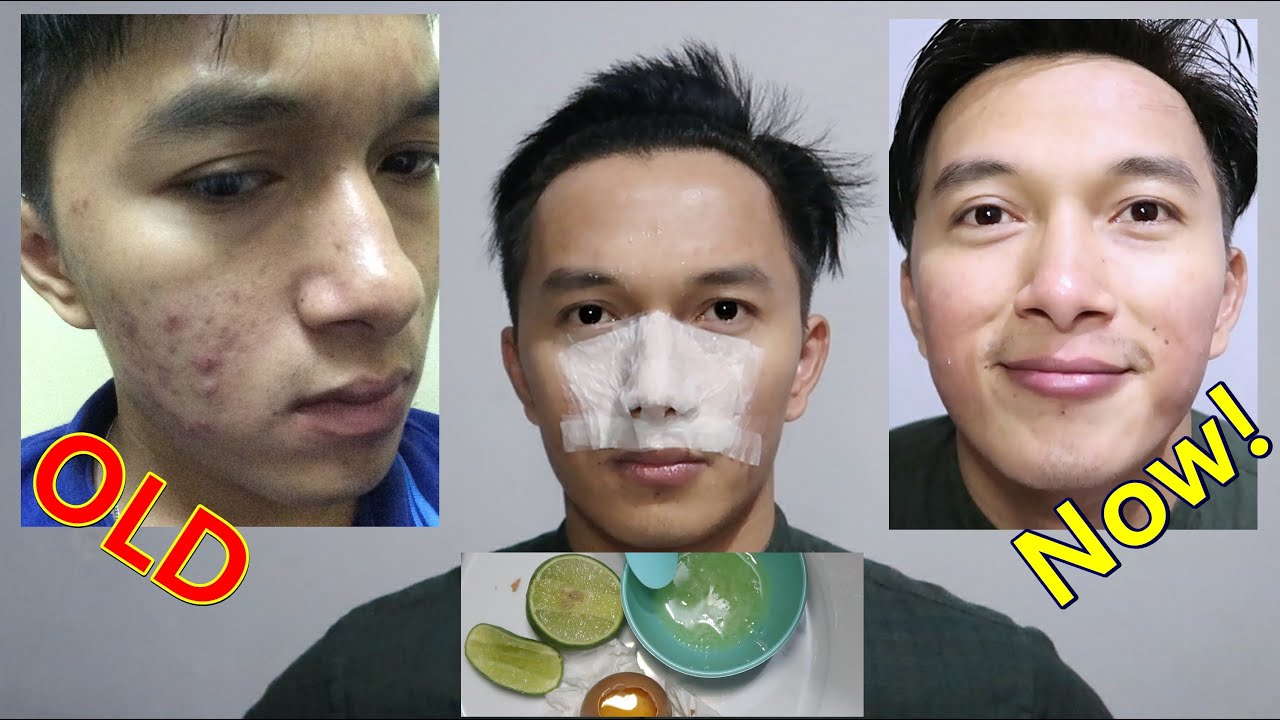 Detail Masker Wajah Putih Telur Nomer 21