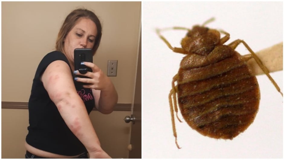 Detail Pic Of Bedbugs Nomer 45