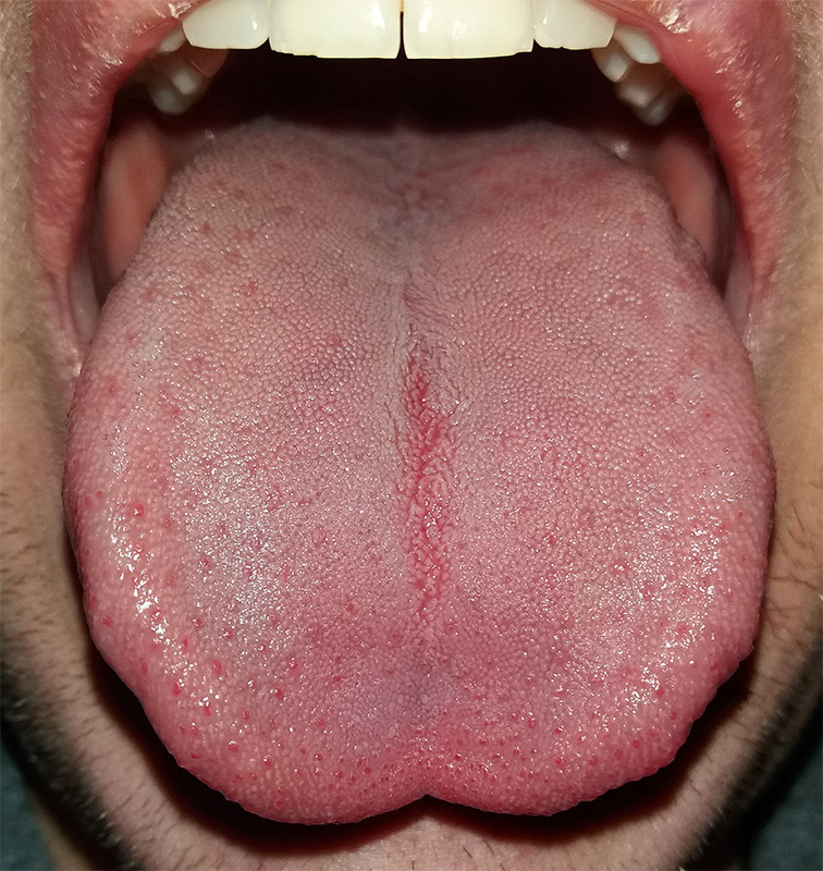 Detail Pic Of Tongue Nomer 2