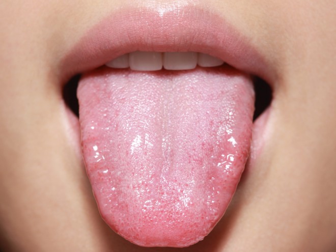 Detail Pic Of Tongue Nomer 13