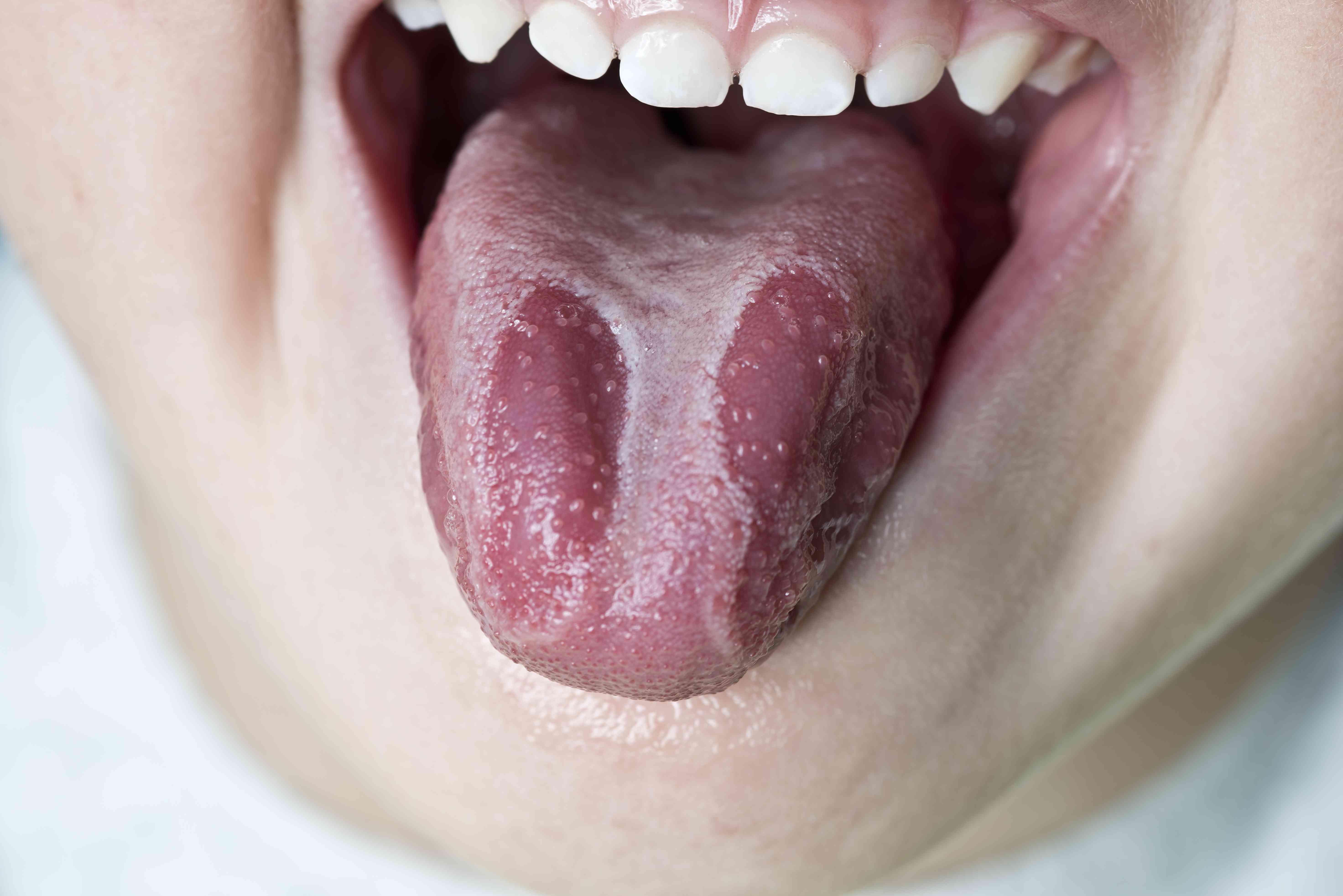 Detail Pic Of Tongue Nomer 17