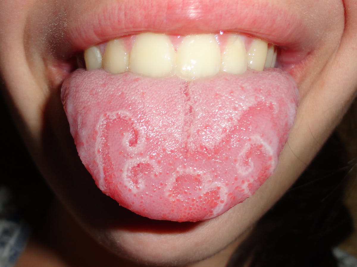 Detail Pic Of Tongue Nomer 20