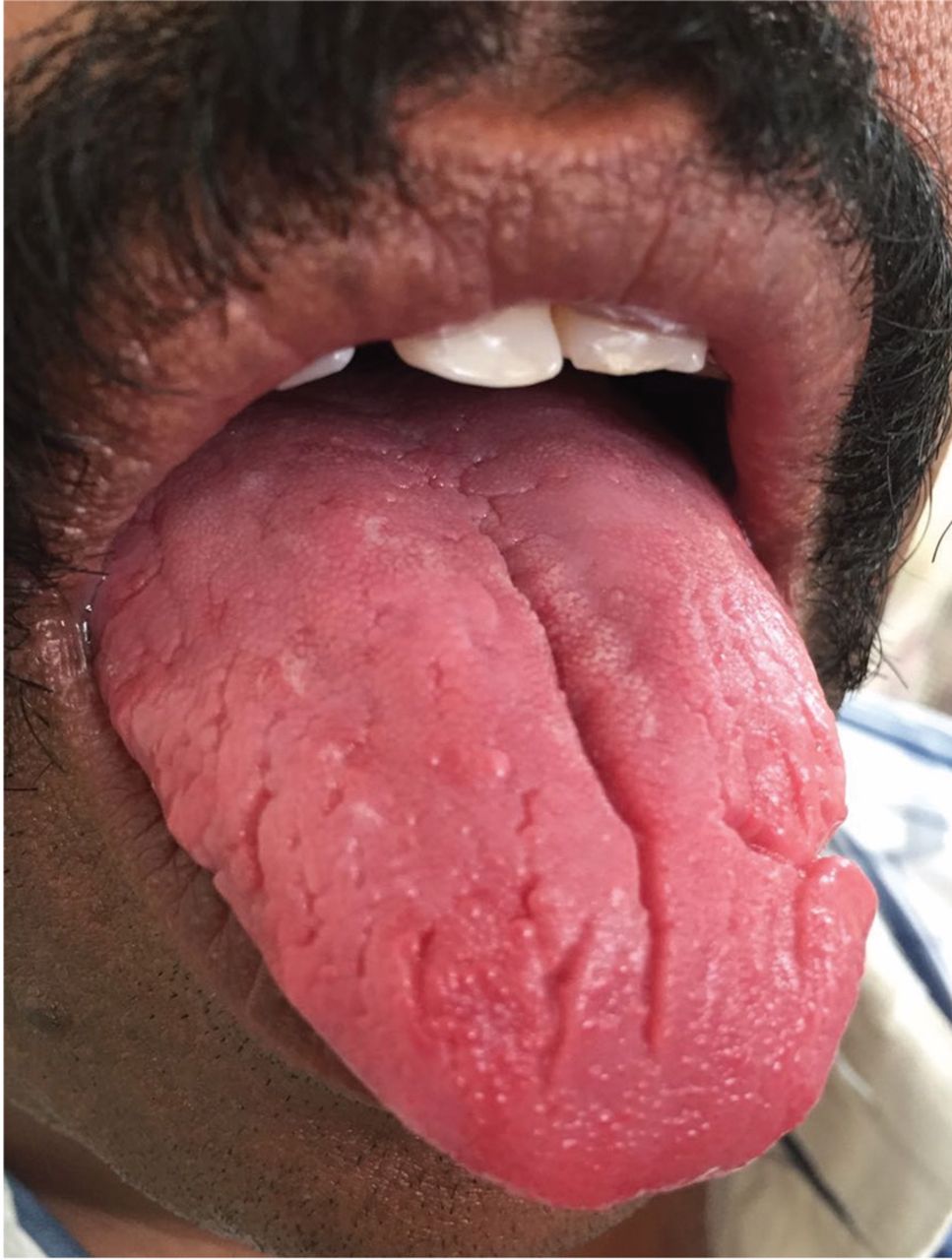Detail Pic Of Tongue Nomer 25