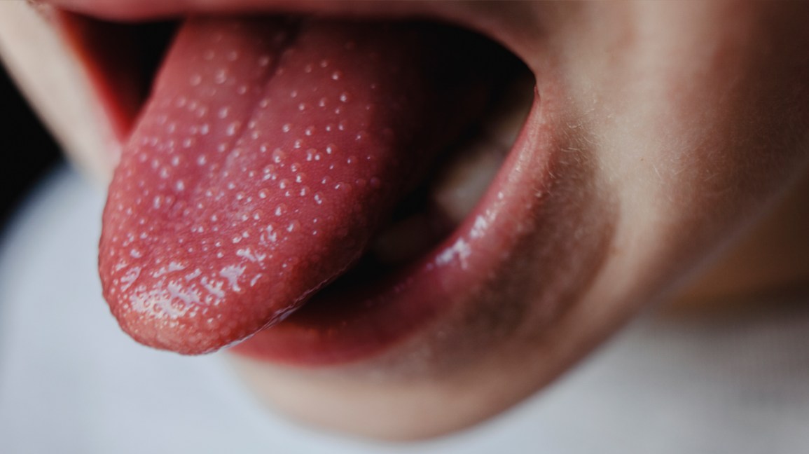 Detail Pic Of Tongue Nomer 5