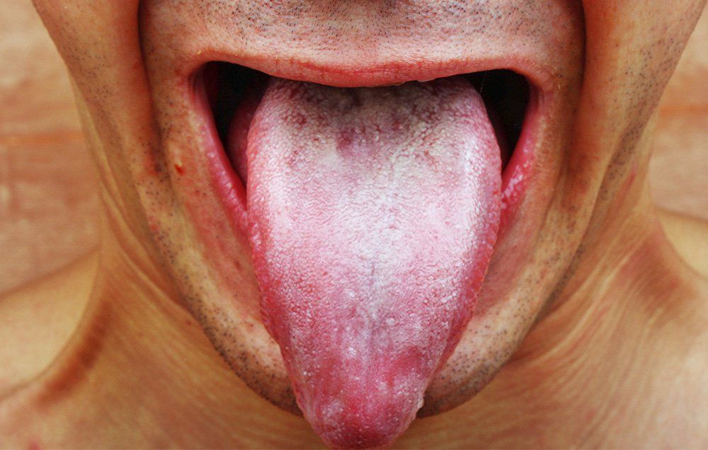 Detail Pic Of Tongue Nomer 51