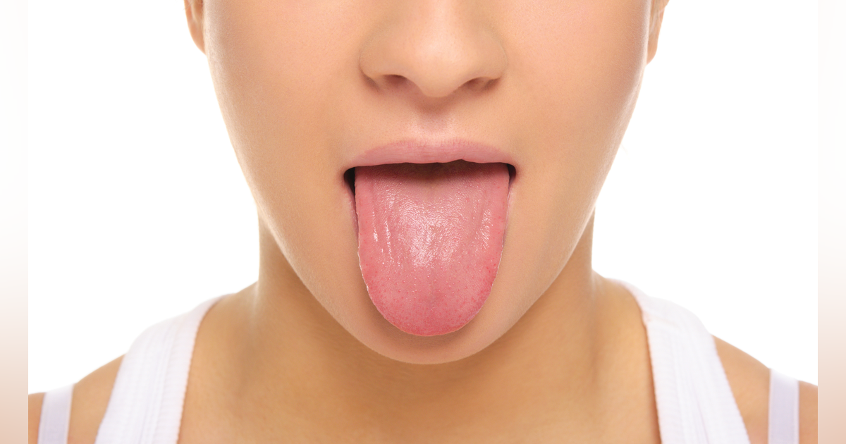 Detail Pic Of Tongue Nomer 7