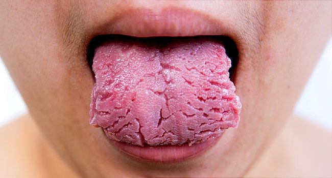 Detail Pic Of Tongue Nomer 8
