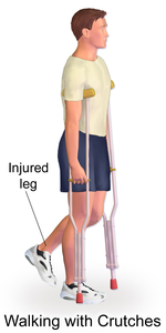 Detail Pics Of Crutches Nomer 16