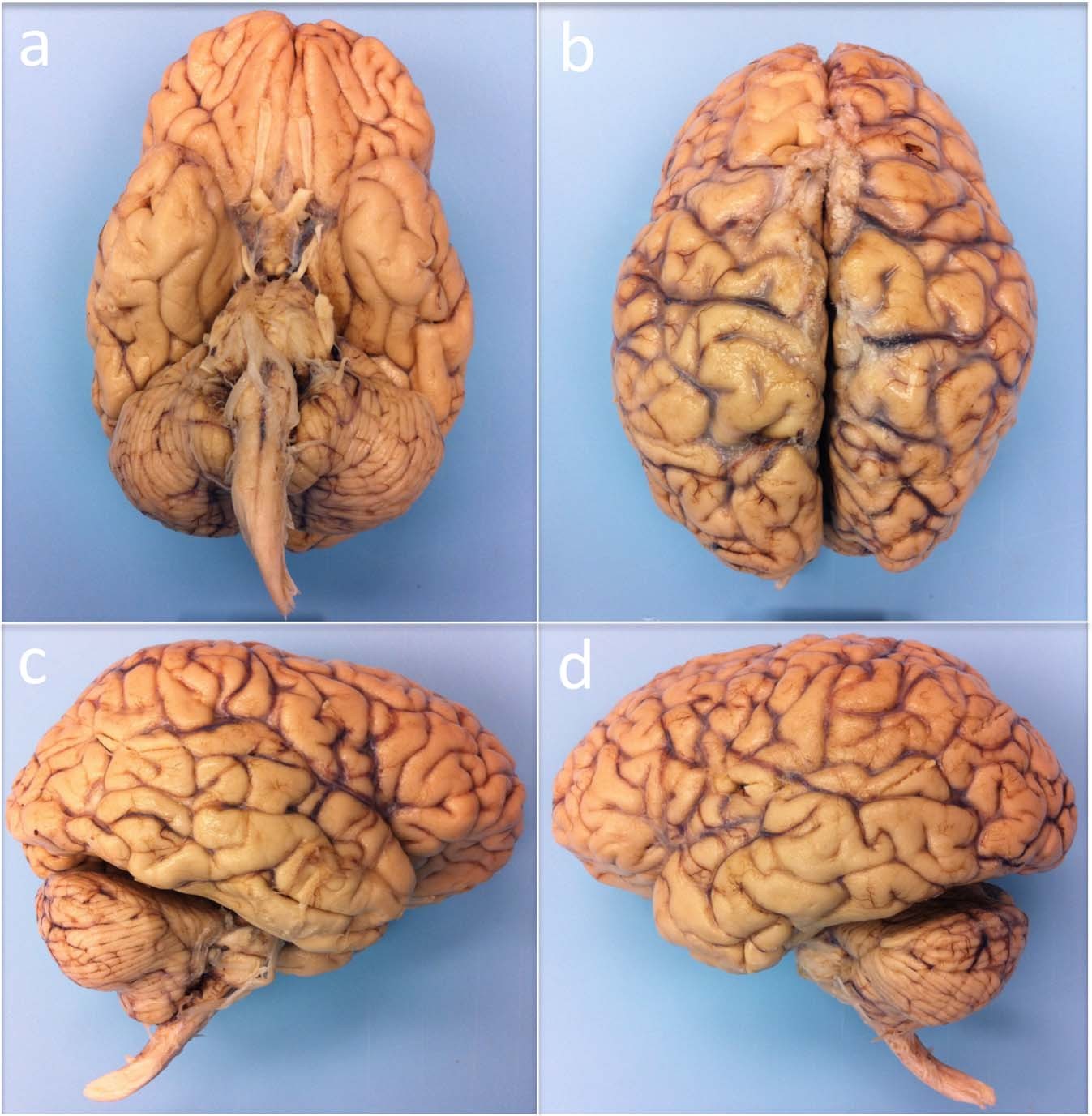 Detail Pics Of Human Brains Nomer 13