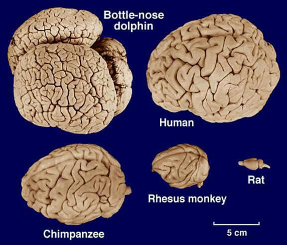 Detail Pics Of Human Brains Nomer 14