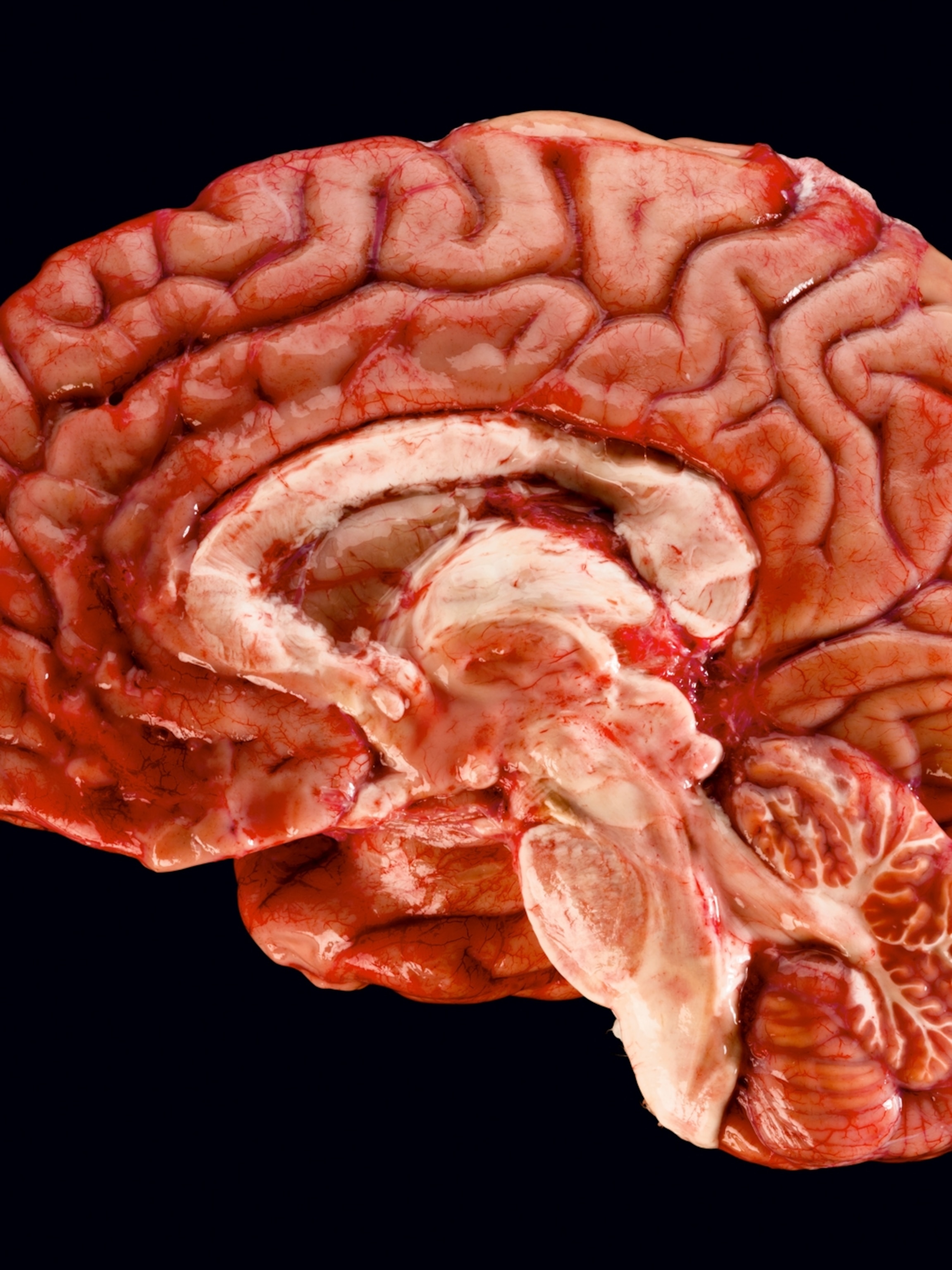 Detail Pics Of Human Brains Nomer 19