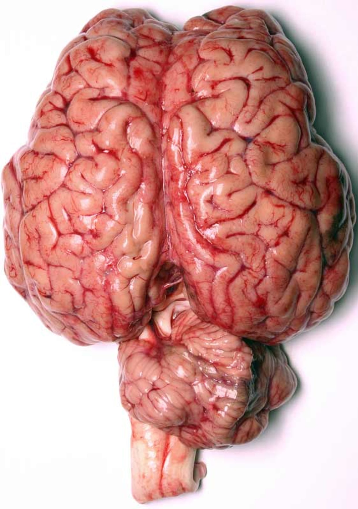 Detail Pics Of Human Brains Nomer 3