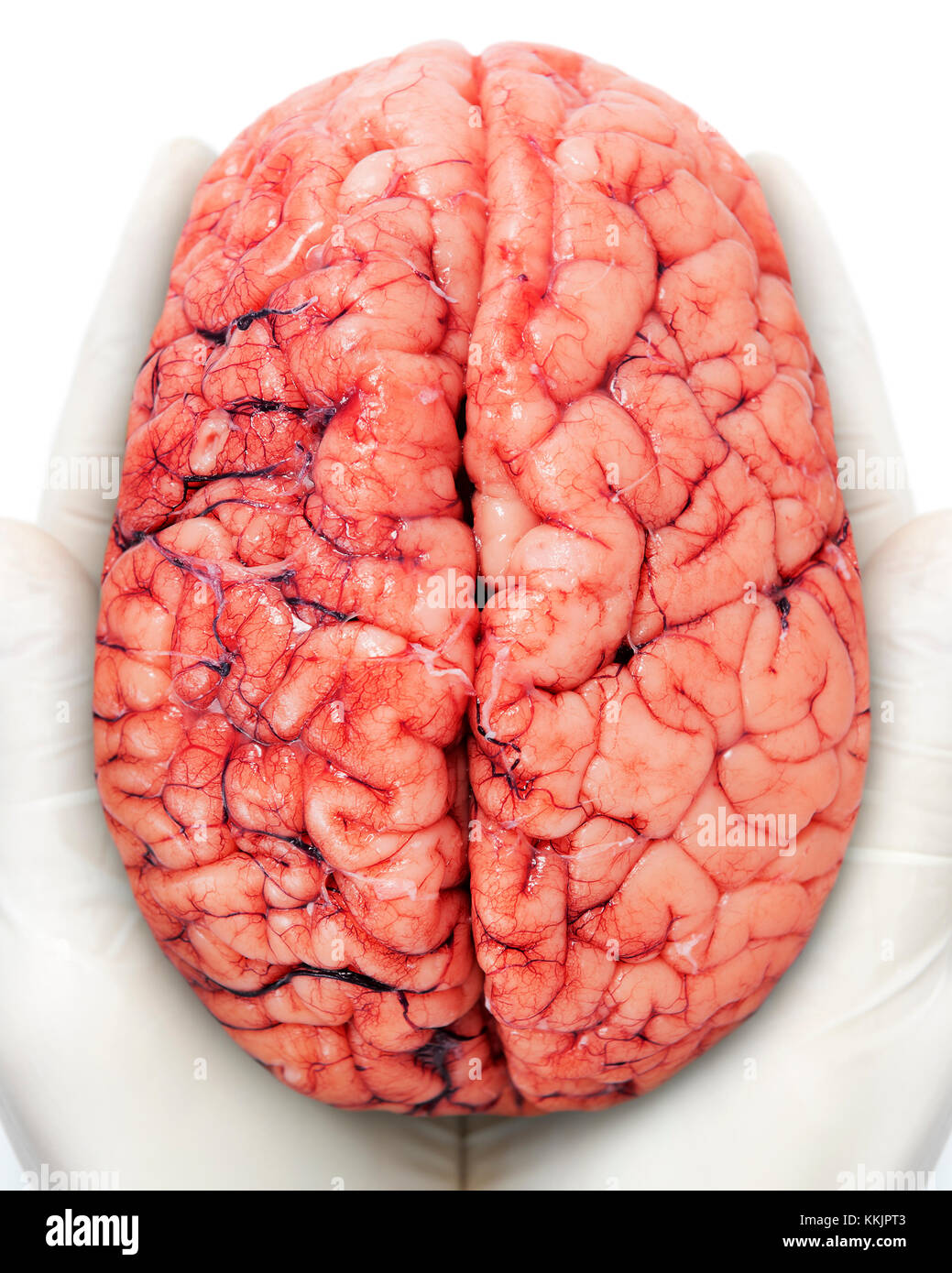 Detail Pics Of Human Brains Nomer 28