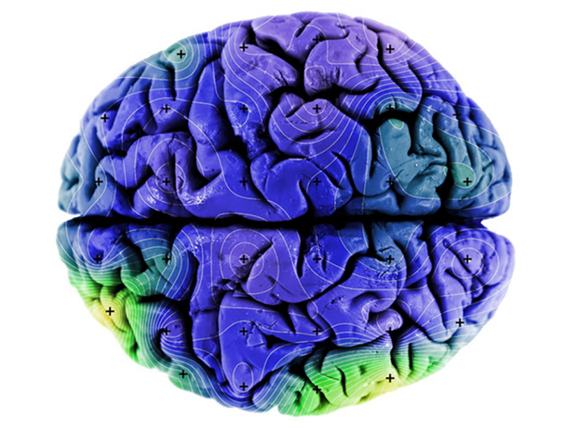 Detail Pics Of Human Brains Nomer 49