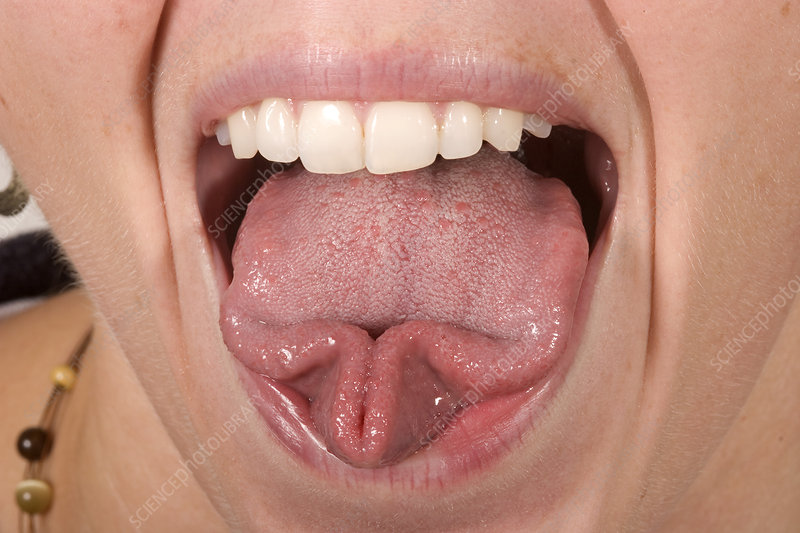 Detail Picture Of A Tongue Nomer 35