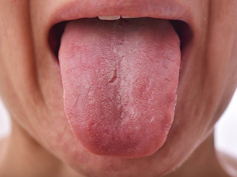 Detail Picture Of A Tongue Nomer 8