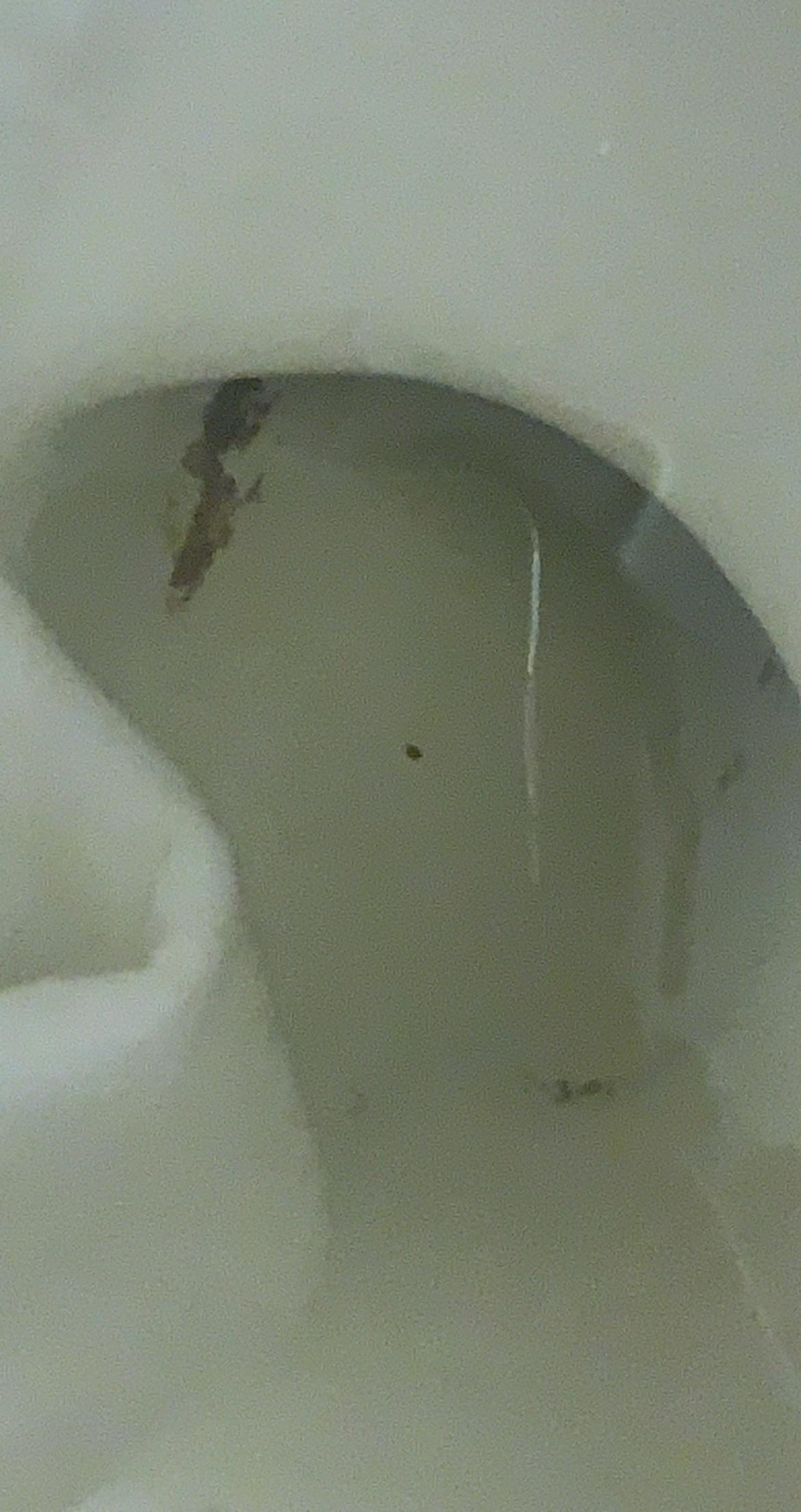 Detail Picture Of Kidney Stone In Toilet Nomer 15
