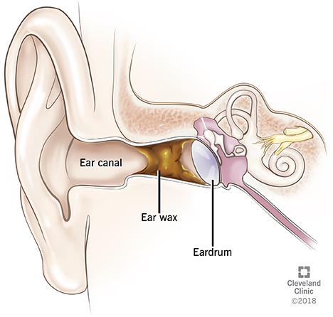 Detail Picture Of The Ear Nomer 35