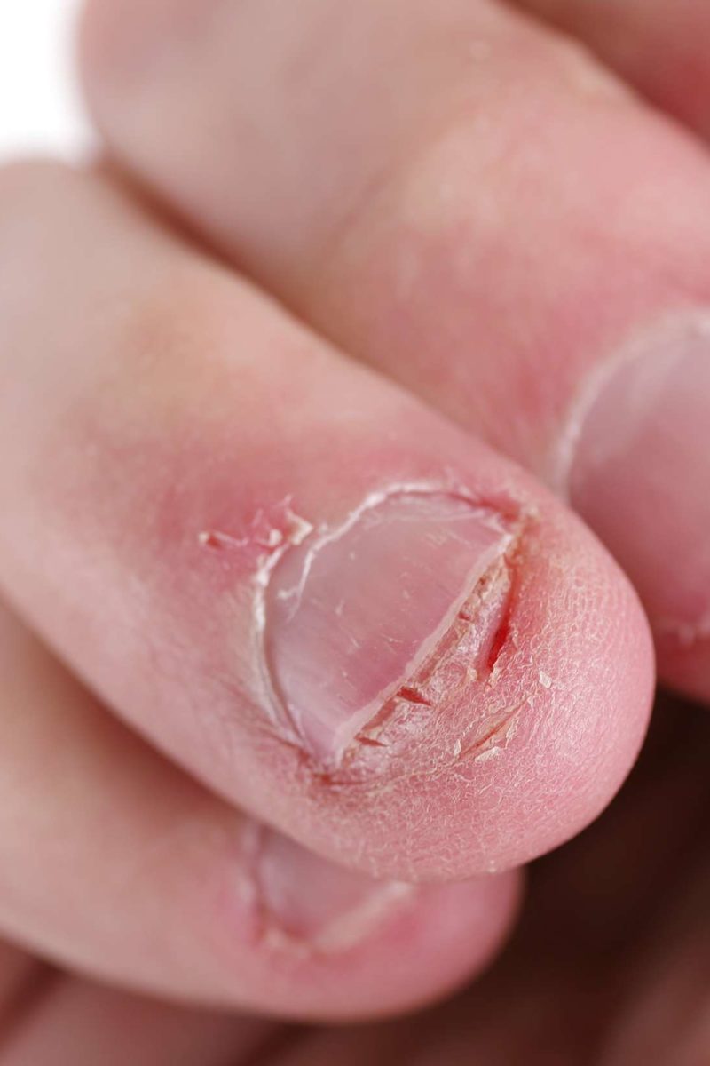Detail Pictures Of Fingernails Nomer 14