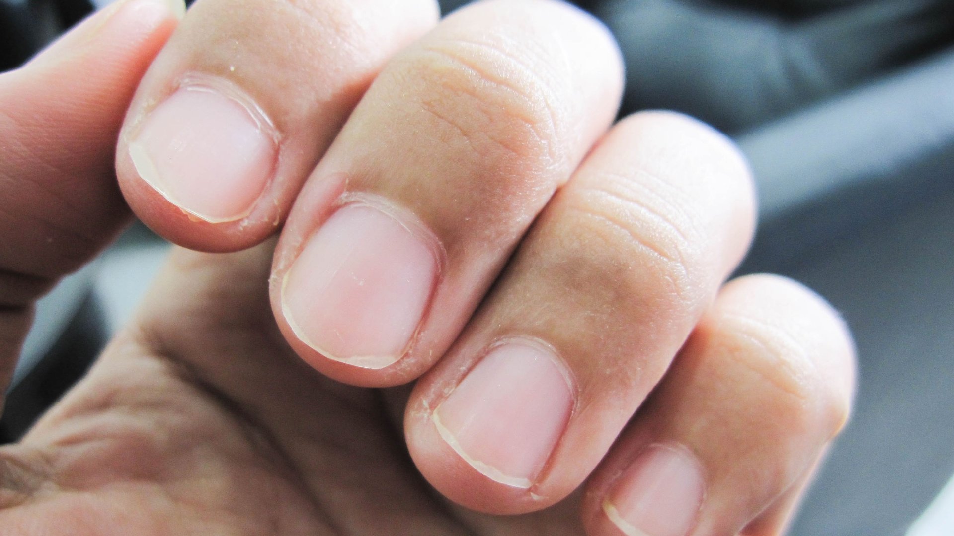 Detail Pictures Of Fingernails Nomer 15
