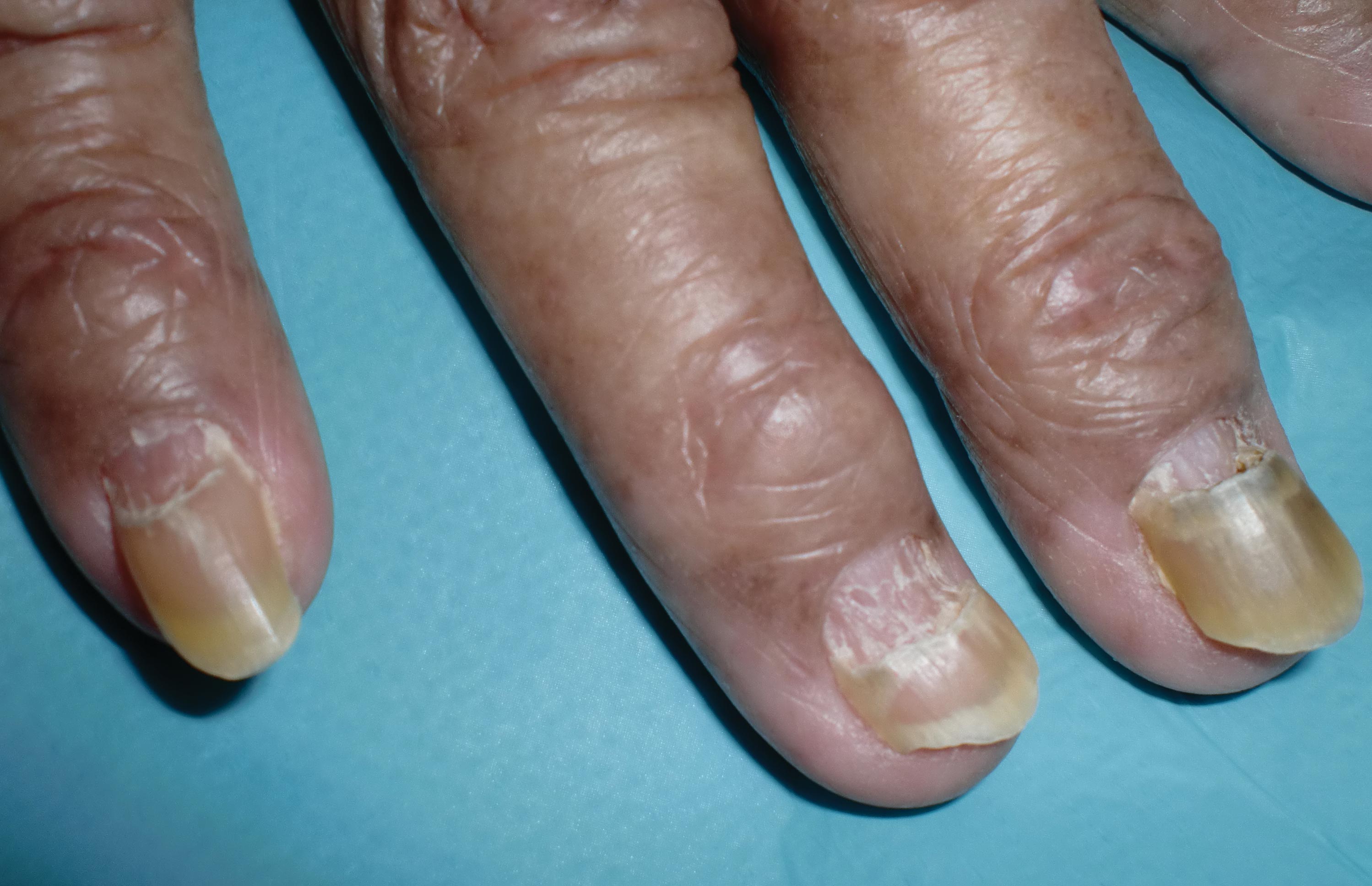 Detail Pictures Of Fingernails Nomer 40